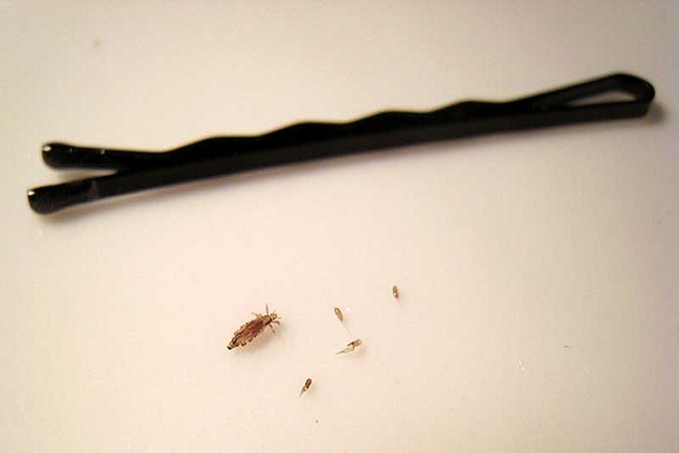 Ways to treat lice at home2