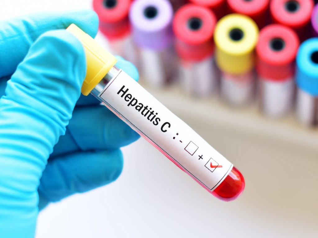 What is hepatitis B Ways to treat hepatitis b