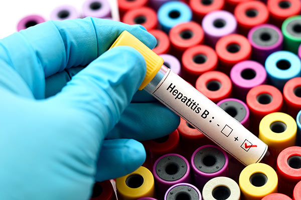 What is hepatitis B Ways to treat hepatitis b22