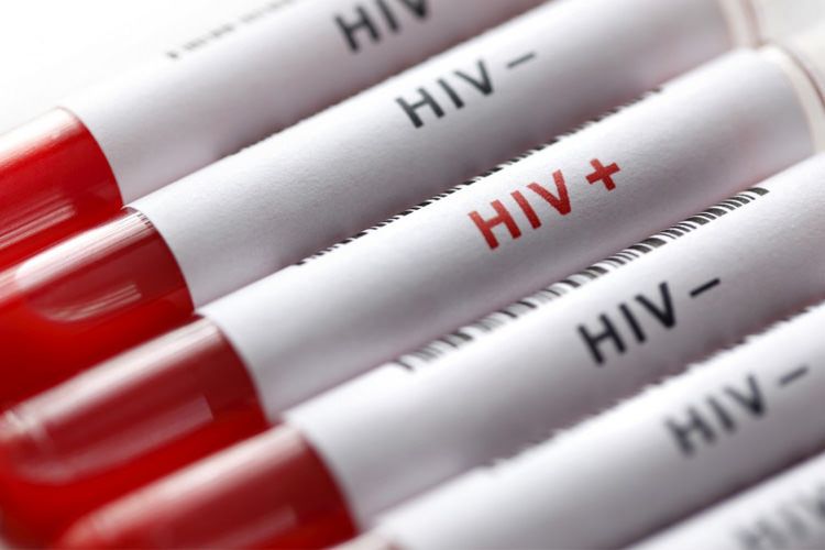 What is HIV1